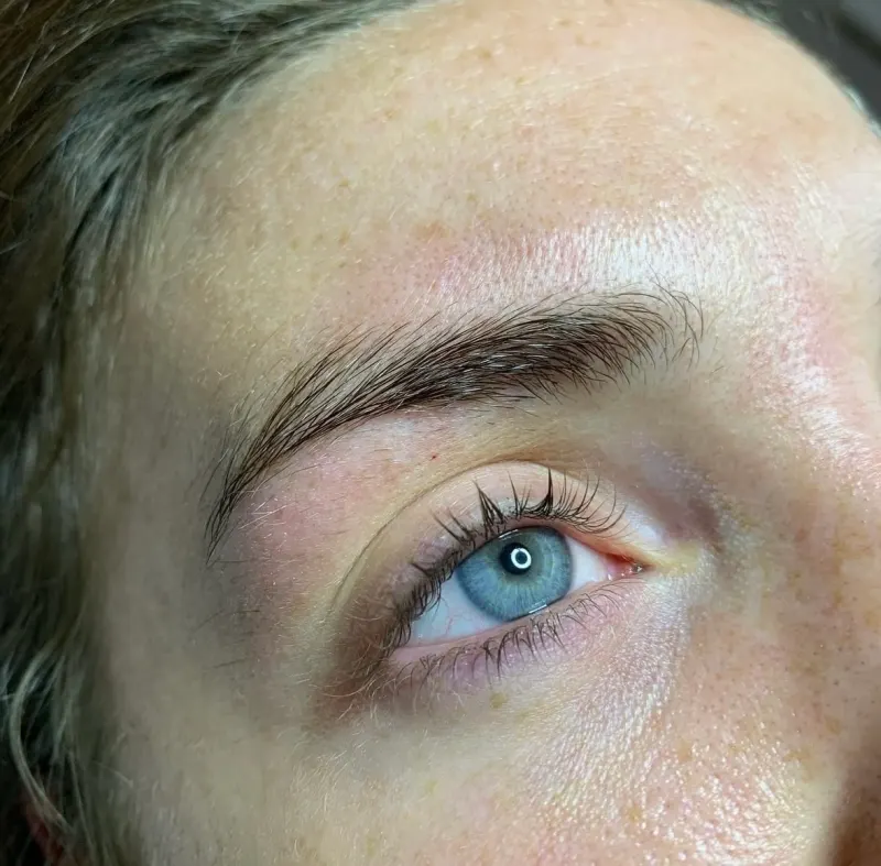 Eyebrows before treatment